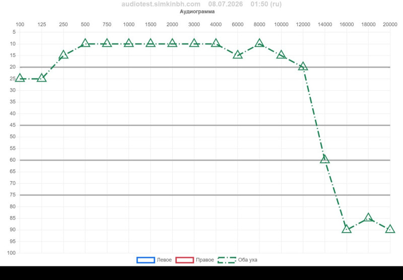 Audiogram  08.07.2026    01-50.jpg